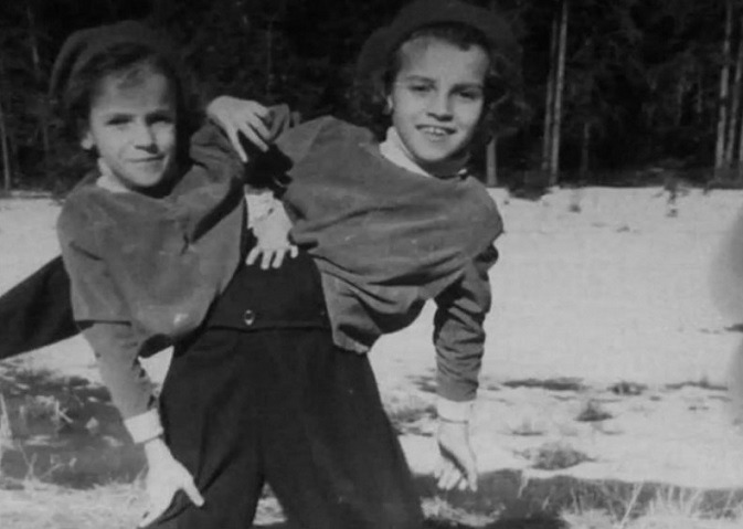 Сестры Кривошляповы: что стало с самыми известными сиамскими близнецами