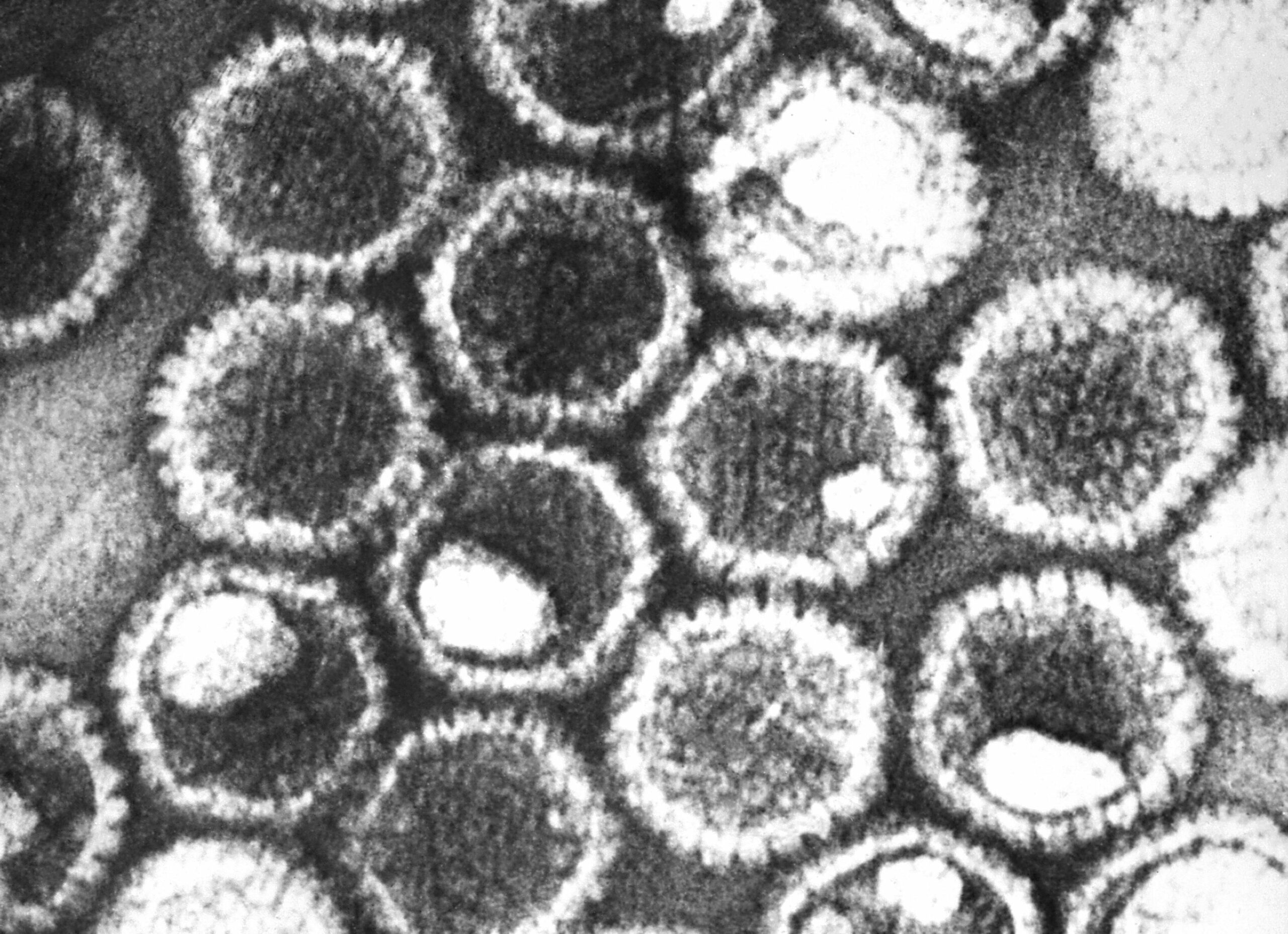 Вирус герпеса под микроскопом