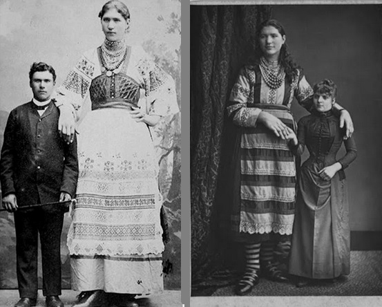 «Кровать перевозили в отдельном вагоне»: как жилось самой высокой русской девушке